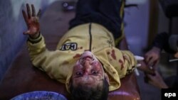 A Syrian child receives first aid in a field hospital following an air strike by forces loyal to the Syrian government in the rebel-held area of Douma, on the outskirts of Damascus, on November 10.