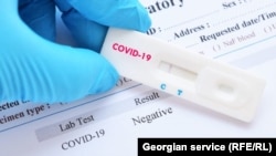 Testele rapide pentru depistarea COVID-19 sunt de multe ori irelevante