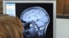 Мозг человека на экране томографа