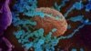 Sars-Cov 2, în albastru, după ce a infestat un țesut, surprins de microscopul electronic