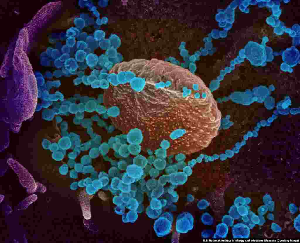 SARS-CoV-2 virions emerging from a human cell. All photos in this gallery were colorized using either feature-detection software or Photoshop. &nbsp; &nbsp; &nbsp;