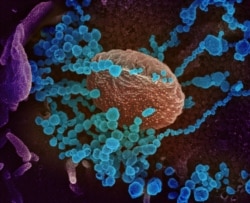 Вирионы SARS-CoV-2, разрастающиеся в клетке человеческого организма