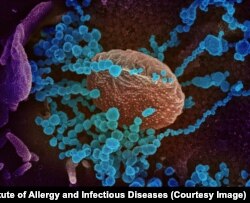 Вирионы SARS-CoV-2, разрастающиеся в клетке человеческого организма