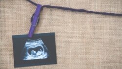 سقط جنین؛ مسئله «زن و بدنش» یا «قانون و جامعه»؟