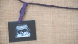 سازمان‌های امضاکنندهٔ این بیانیه از جمهوری اسلامی خواسته‌اند «برنامه‌های جامع تنظیم خانواده» را احیا و قوانین جرم‌انگاری سقط جنین را «فوراً» لغو کند