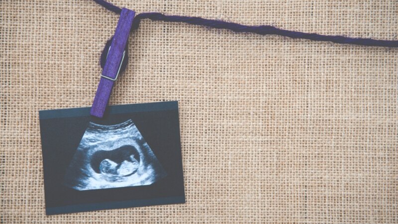 تصویب قانون سخت‌گیرانه برای سقط جنین در یک ایالت دیگر آمریکا