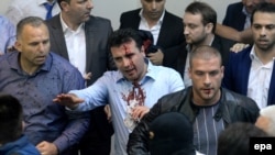 Zoran Zaev (center) was injured in the 2017 invasion of the parliament in Skopje.