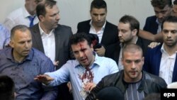Ҳужум давомида ўнлаб парламент аъзоси ҳамда журналист жароҳат олган эди. Улар орасида кейинроқ бош вазир этиб сайланган Зоран Заев (ўртада) ҳам бўлган.