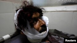 An wounded man receives treatment after the attack in Jalalabad on May 10. 