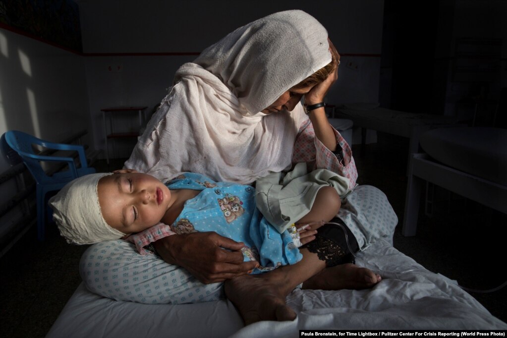 Në një spital në Kabul, Najiba mban në duar nipin e saj dy vjeçar Shabir, i cili është plagosur nga shpërthimi i një bombe.