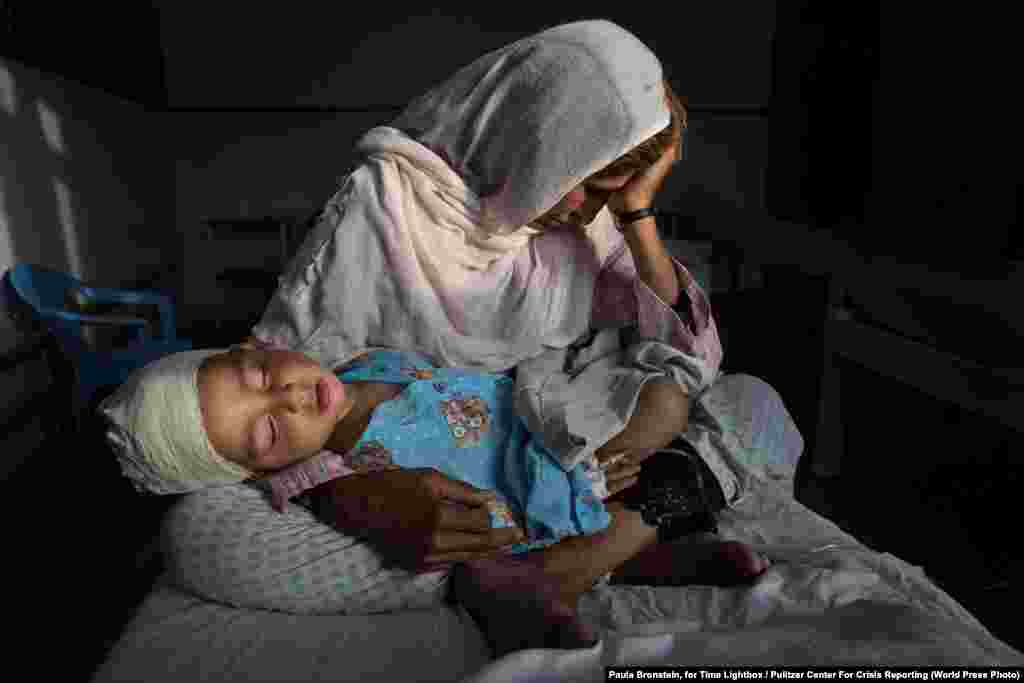 At a hospital in Kabul, Najiba holds her two-year-old nephew Shabir who was injured from a bomb blast on March 29, 2016. Daily Life -- First Prize, Singles (Paula Bronstein, for Time Lightbox/Pulitzer Center For Crisis Reporting)