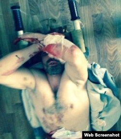 Житель дагестанского села Рутул Аким Кулиев в 2017 году порезал себя, не выдержав пыток сотрудниками ЦПЭ