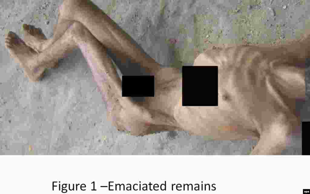 An undated photograph of an emaciated man made available by Carter-Ruck solicitors, the legal team that says it verified the authenticity of the images.