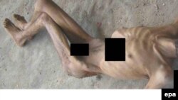 Syria Accused Of Systematic Torture