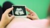 Një grua shtatzënë duke shikuar ultrazërin. Fotografi nga arkivi.