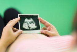 Беременная женщина смотрит на УЗИ. Иллюстративное фото