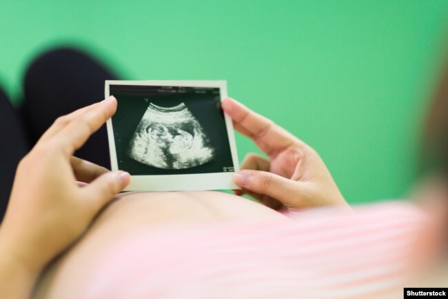 Беременная женщина смотрит на УЗИ. Иллюстративное фото