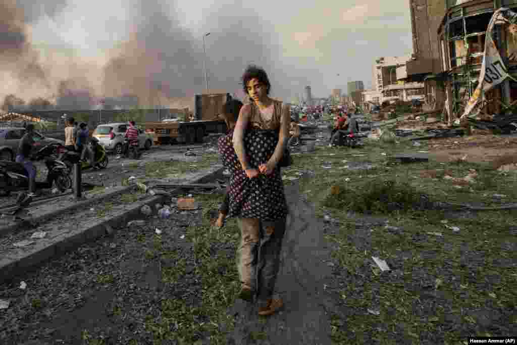 Жыхар Бэйруту ратуе сваю 11-гадовую пляменніцу Ходу неўзабаве пасьля моцнага выбуху ў порце 4 жніўня 2020