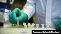 Disa mostra testimi të koronavirusit në një laborator në Gjermani. 