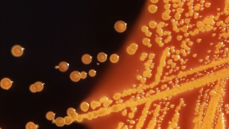 دانشمندان کدهای ژنتیک سه هزار باکتری خطرناک را ترسیم کردند