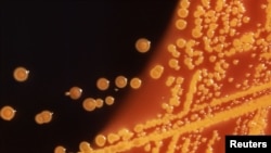 Колонія бактерії E. Coli (кишкова паличка). Вона зазвичай нешкідлива, але деякі її штами викликають серйозні захворювання і мають стійкість до різних антибіотиків