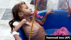 «سیو د چیلدرن» گفته است از هر کودک یمنی که بر اثر شلیک گلوله و یا بمب می‌میرد، ده‌ها کودک بر اثر گرسنگی و سوءتغذیه جان می‌دهند.