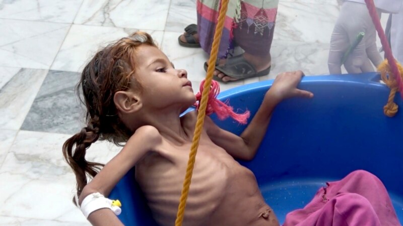 یمن کې څه باندې پنځه میلیونه ماشومان د لوږې له خطر سره مخ دي