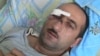Jurnalist İdrak Abbasov hədələrin davam etdiyini deyir 