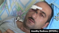 Journalist Idrak Abbasov was beaten by state security agents in April.
