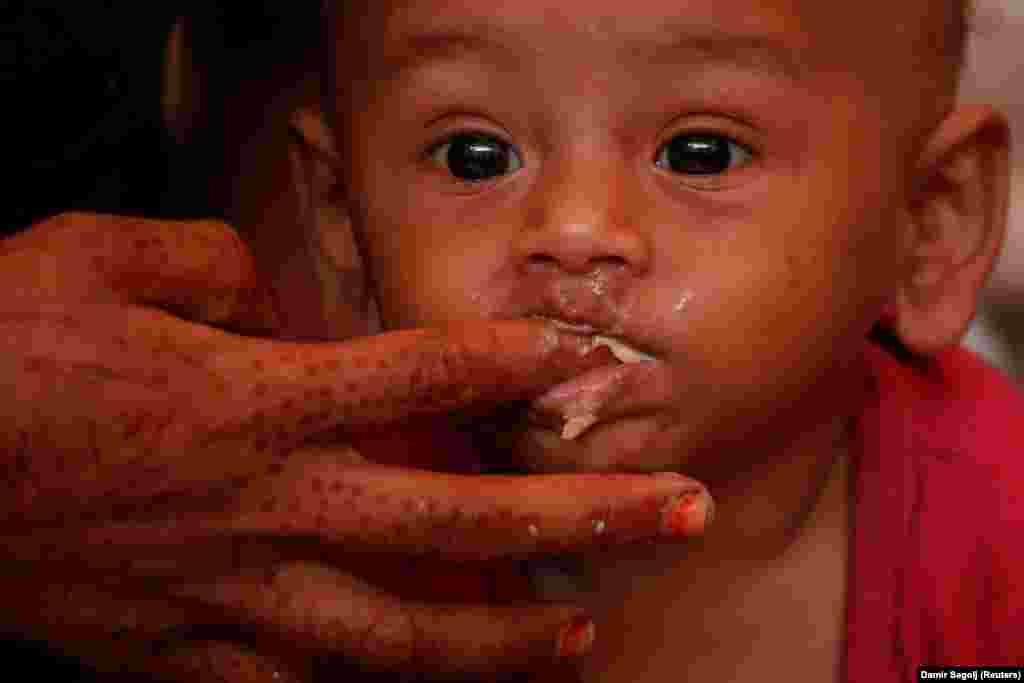 A malnourished child is fed at a UNICEF medical center at the Balukhali refugee camp near Cox's Bazar, Bangladesh. (Reuters/Damir Sagolj)
