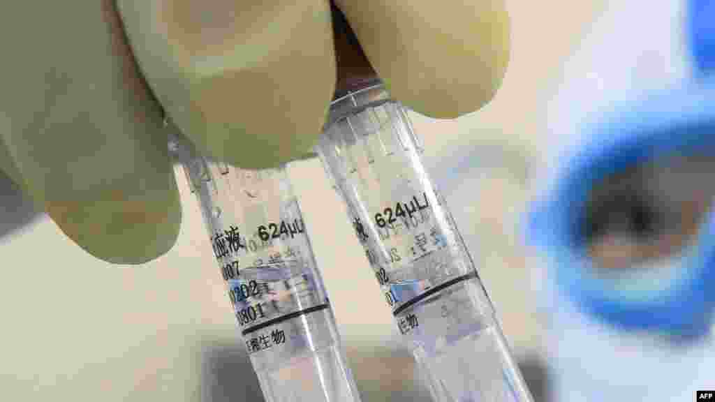 МАКЕДОНИЈА - Министерството за здравство информираше дека во изминатите 24 часа се регистрирани 12 нови случаи на коронавирус во земјава. Од нив, 7 се од Скопје и 5 од Куманово.