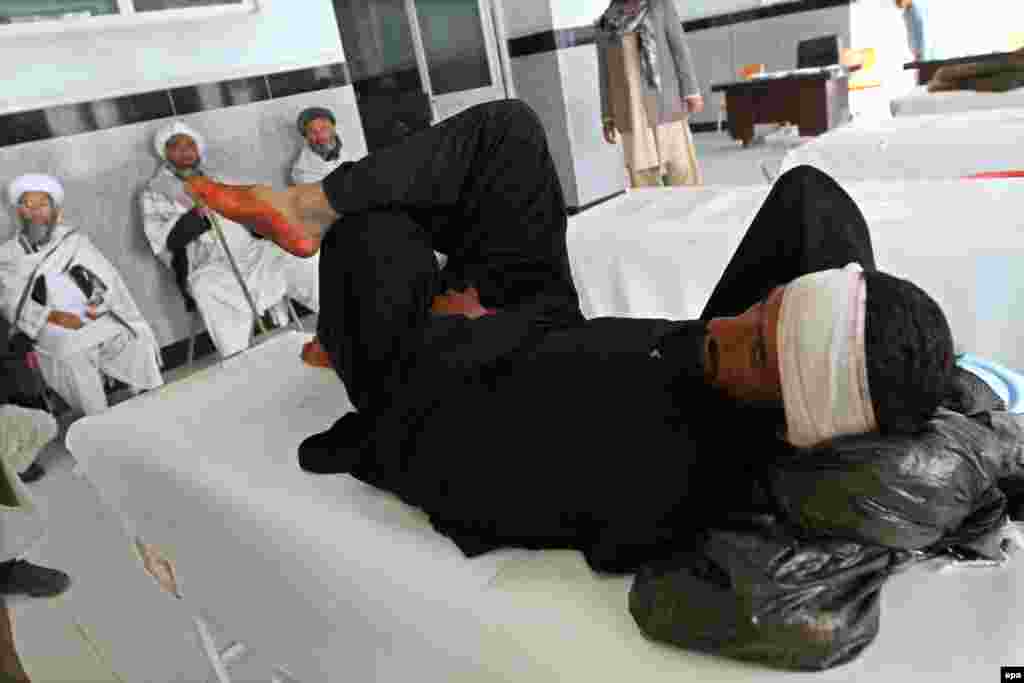 An Afghan man receives treatment in a Herat hospital after he was wounded during the attack.