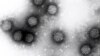 Kronične infekcije izazvame hepatitisom B, hepatitisom C, papiloma virusom, česti su uzroci karcinoma - microskopski prikaz humanog papiloma virusa odgovornog za rak materice