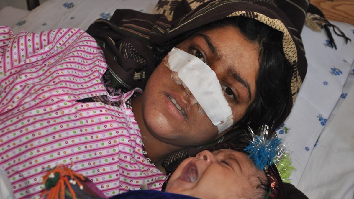 Afghan Womans Nose Cut Off By Her Husband