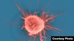 Ilustrativna fotografija, ćelija raka