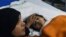 An injured Pakistani child victim of a suicide blast rests in a hospital in Lahore on March 28, 2016.