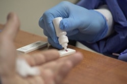 Një doktor kryen një test të shpejt për koronavirus. Foto nga arkivi.