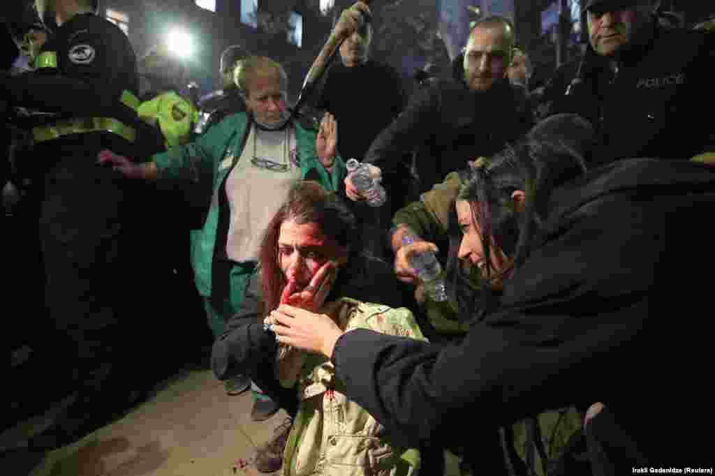 Anna Subeliani, a well-known civil rights activist, is left bleeding after a stone was reportedly thrown at her during the screening of And Then We Danced, in Tbilisi. 
