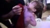 Ребенок, пострадавший во время химической атаки в сирийском городе Дума, кадр из видео