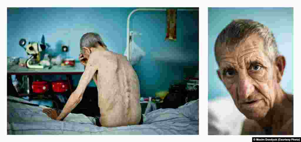 Photographer Maxim Dondyuk of Ukraine was selected in the Portraiture category for this shot of Michael, 63, who was being treated for tuberculosis in a hospital in Kherson.