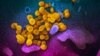 Noul coronavirus (în galben), văzut la microscop electronic