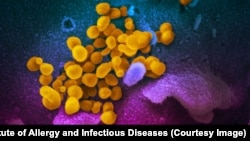Coronavirus (în galben) infestând un țesut uman