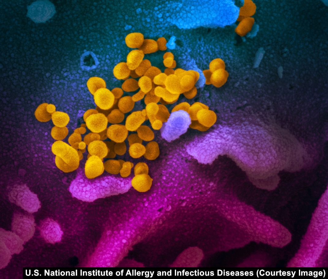 Up Close With The Enemy: The Coronavirus In Stunning Detail