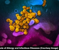 Увеличенное электронным микроскопом и раскрашенное изображение вирусов SARS-CoV-2 (желтые)