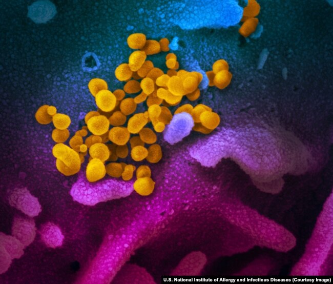 Увеличенное электронным микроскопом и раскрашенное изображение вирусов SARS-CoV-2 (желтые)