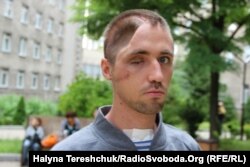 Український воїн Олександр Беспалов вірить в одужання