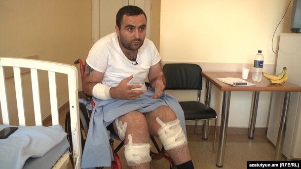 Armenia -- Robert Ananyan, a journalist for A1+ TV station injured in Sari Tagh, speaks to RFE/RL in hospital, 2Aug2016