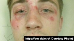 Pretučeni Dejan Bagarić