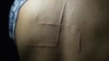 Bohdan Serhiyets spent only 10 hours in jail in May 2014, but in that time Russia-backed separatists carved a swastika on his back and pulled out two of his fingernails. Serhiyets remembers his torturers saying they shouldn’t let him out alive so no one could see what they had done to him.