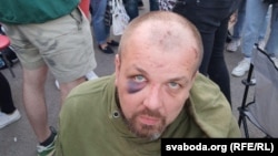 Как выглядят люди после СИЗО в Минске